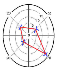 brain assessment - personality assessments