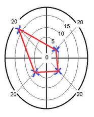 brain assessment - personality assessments